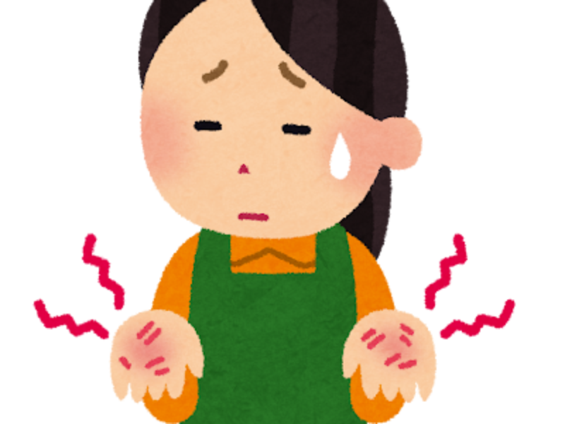 しもやけの症例…80代女性